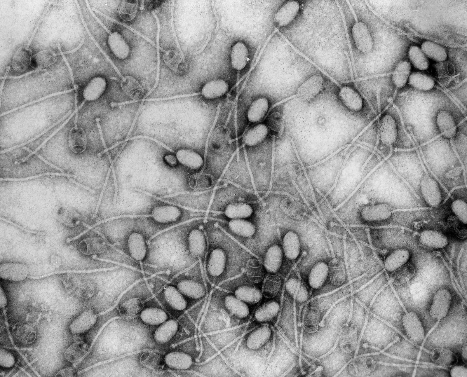 Micrografia elettronica a contrasto negativo di batteriofagi di Staphylococcus aureus. Decine di particelle con testa ovale scura e coda lunga e sottile, sparse su un fondo chiaro.