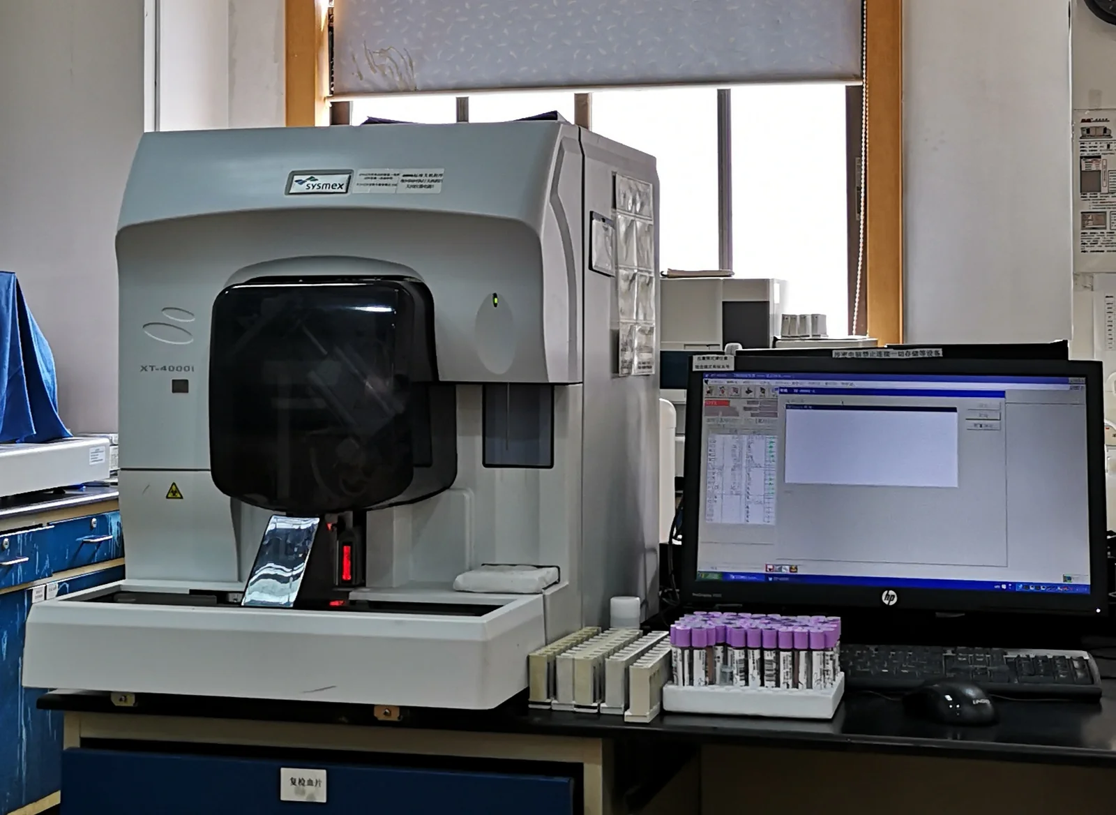 Analizzatore ematologico clinico con provette di sangue dal tappo viola in rack pronte all'analisi, lettore di codice a barre acceso e monitor del sistema informativo di laboratorio accanto.